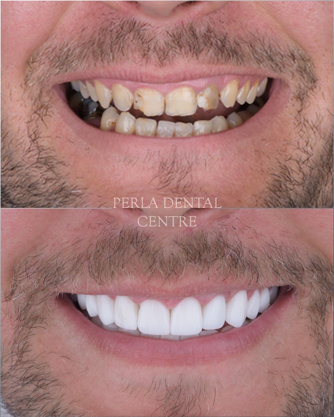 Dental treatment result 1